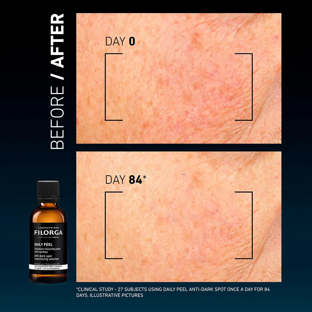 FILORGA- DAILY PEEL SERUM ANTIMANCHAS 50 ML