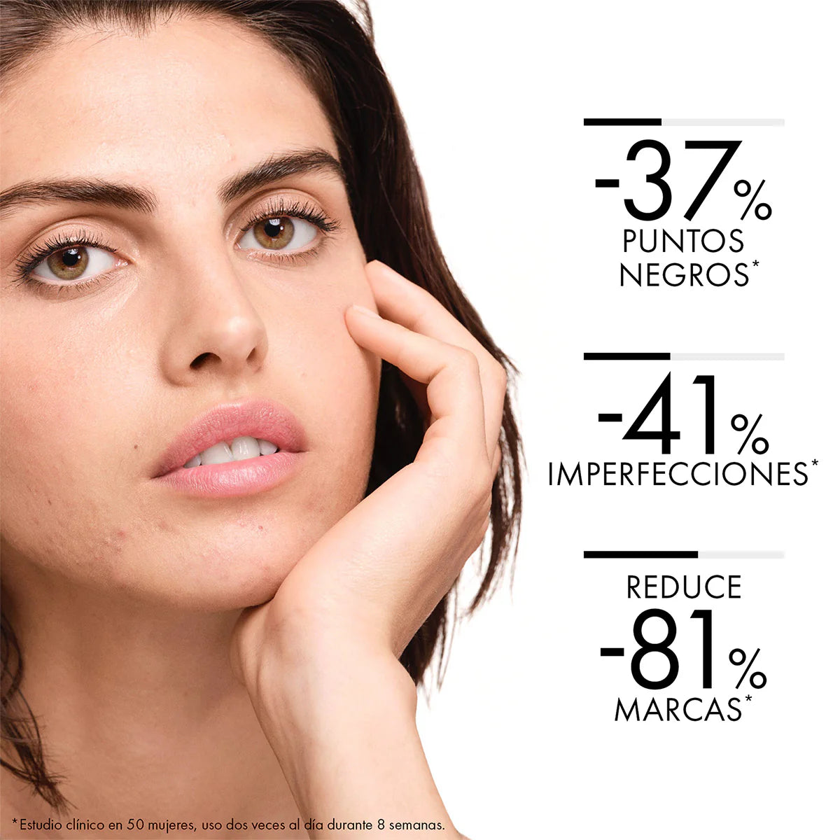 VICHY- NORMADERM CREMA 50ML